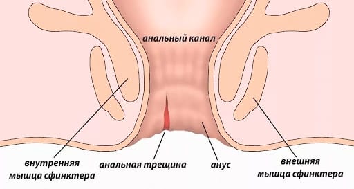 anal yoriq sabablari belgilari va davolash usullari 65d3729d68eba