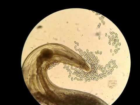 askaridoz xavfli kasallik haqida malumot 65da21f778658