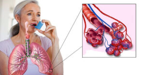 astma davosizmi 65cab950b43c1