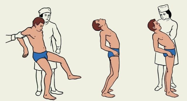 ataksiya tik tura olmasdan chayqalib yurish haqida malumot 65da22018d79f