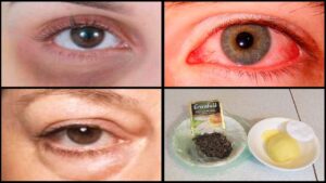 kocabbz osti qorayishi 65cbc66462854