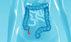 korichakning asosiy alomatlari 65caa9cf03a5b