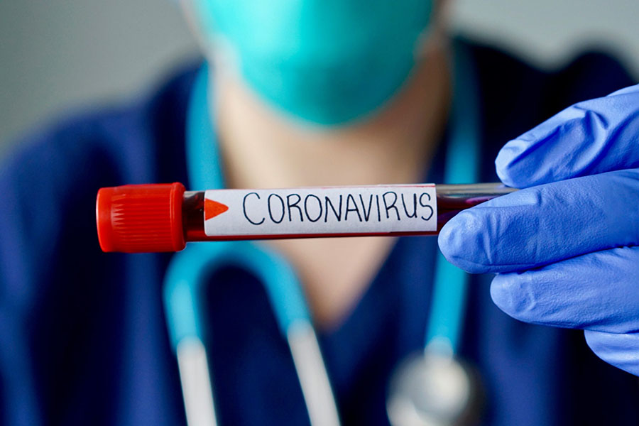 koronavirus covid 19 kasalligi jsst korsatmalari 65d8dbb29904f