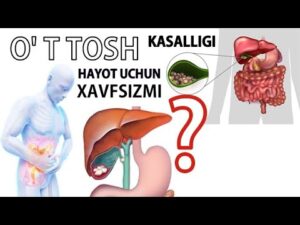 Nima sababdan o‘t pufagida tosh paydo bo‘ladi? 2 nima sababdan ot pufagida tosh paydo boladi 65cad4c0edc5a