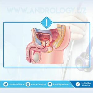 prostatitni oldini olish 65cabd9a2b813