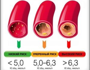 xolesterinni tabiiy yol bilan kamaytirish mumkin 65caafa56a585