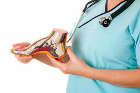 yassioyoqlik yoxud yassitovonlik haqida malumot 65da35ab80b6c