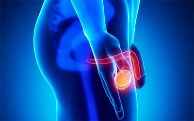 moyak saratoni belgilari va davolash 65f0449b52be9