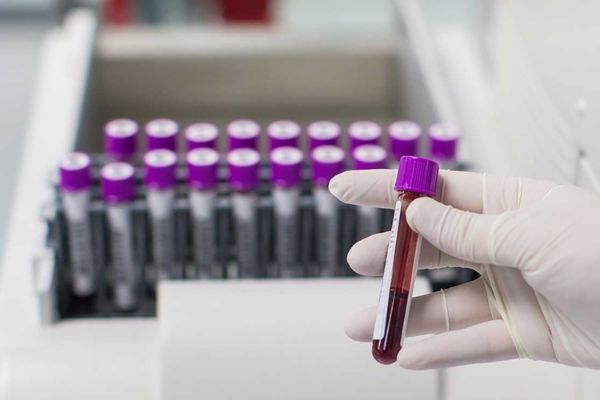 qon testlari nima va uning afzalliklari 65f04a1594a72