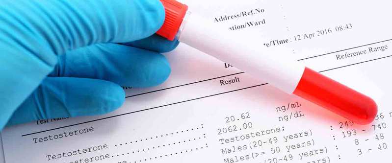 qon testlari nima va uning afzalliklari 65f04a15eafe3