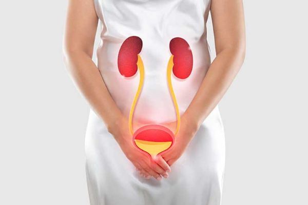 sistit nima va davolash usullari 65f04e58ab502