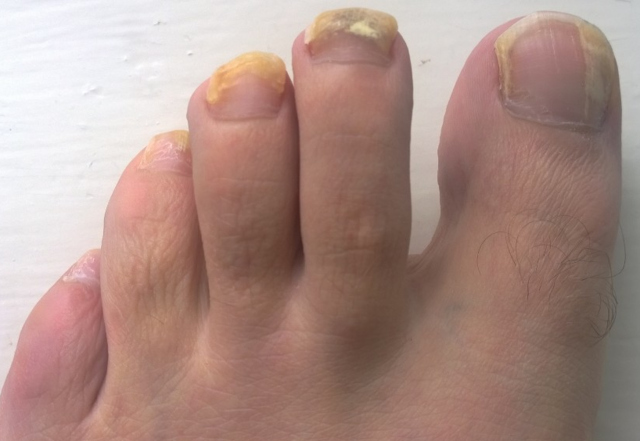 tirnoq sinishiga nima sabab boladi 65f04dee1fa6d