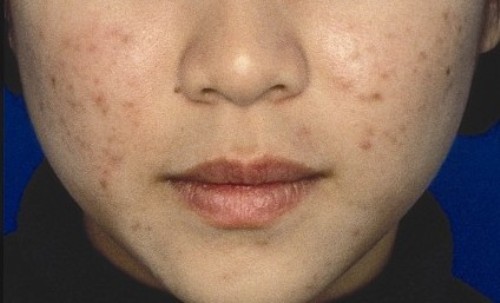 uyda terini qanday parvarish qilish kerak 65f04de2df88e