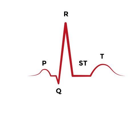 ekg haqida batafsil va ekgning turlari 676ecb595902c