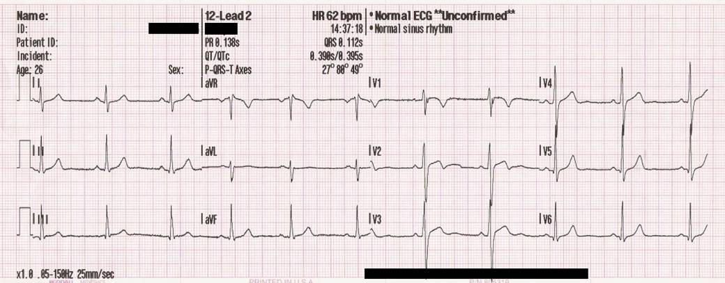 ekg haqida batafsil va ekgning turlari 676ecb599e32a