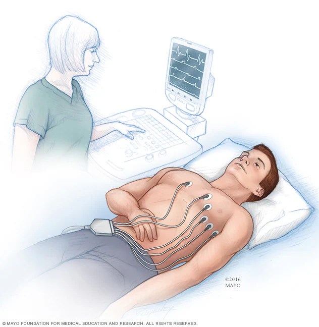 ekg haqida batafsil va ekgning turlari 676ecb5a2c734