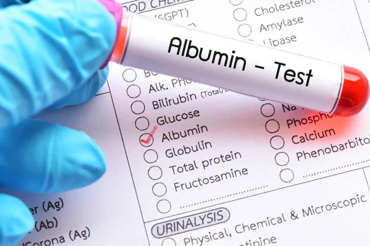 albumin haqida tana uchun muhim oqsil 679cefd467d75