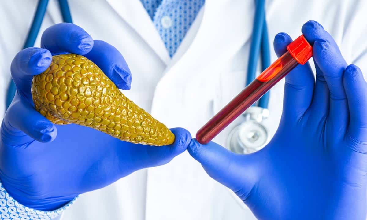 Lipaza: Fermentlarning Muhim Vakili 2 lipaza fermentlarning muhim vakili 679cefe3af64e