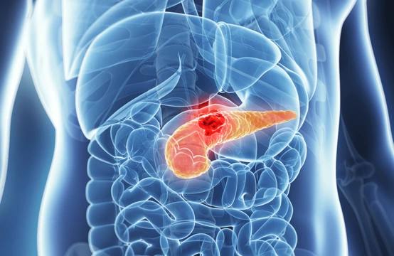 zollinger ellison sindromi haqida 680a5c54d4bd3