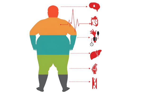 Semizlik sababli ko‘p uchraydigan kasalliklar