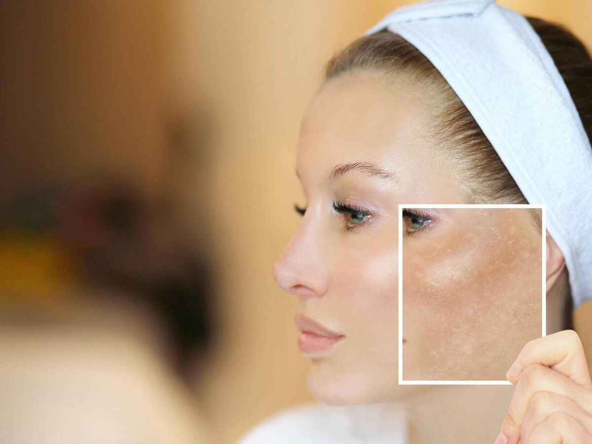 yuzning xiralashishiga nima sabab boladi 68bc56e45992c