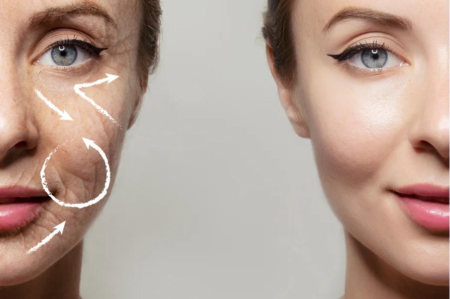 Terini yoshartirish usullari