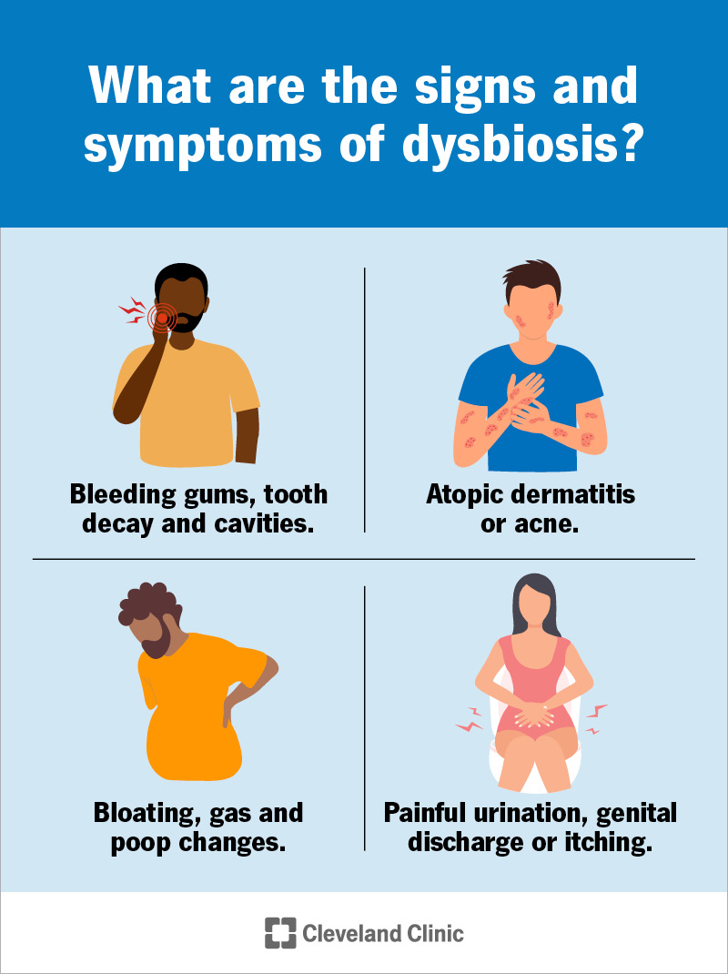 disbioz nima disbioz belgilari nimalar 68ebccfa60e88