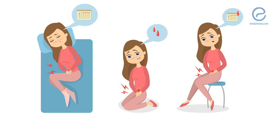 Dismenoreya nima? Qanday davolanadi? 2 dismenoreya nima qanday davolanadi 69174e581746d