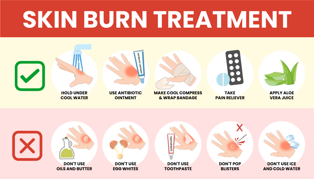 terining kuyishini qanday davolash mumkin 692088e92ec7b