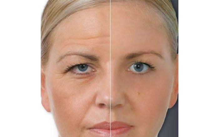 teri osilishini yoqotish boyicha jarrohlik amaliyoti 690e13f62f98a