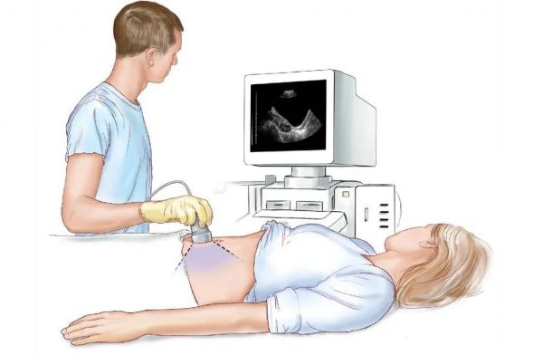 Ultratovush tekshiruvi (UTT) yoki UZI nima